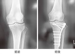 人工関節ドットコム