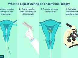 Natural Killer Cells And Infertility What To Know