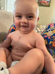 Carson Curry knows. Oh, he's only 4 years old, but he's weathered storms  before, and he's ready to weather this one. Carson is at Children's of  Alabama in Birmingham just 2 weeks