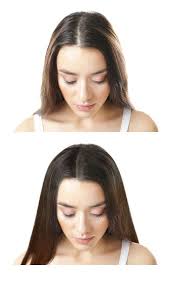 When performed in a clinic, laser therapy will likely cost somewhere in the hundred dollar range — give or take — per session. Hair Loss Treatments Eurocosmetic Hair Loss Clinic Hair Laser Growth Laser Hair Growth Treatment Hair Clinic