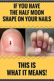 If You Have The Half Moon Shape On Your Nails This Is What It Means Nails Fingernails Health Healthy Healthcare Wel You Nailed It Health Natural Health