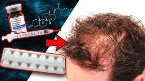 Majority of guys fear anabolics due to the side effects such as hair loss, gynecomastia, water retention, acne, acne scars and even the emotional. Will Taking Deca With Finasteride Cause Hair Loss Youtube