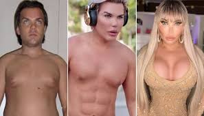 Antes, conhecida como ken humano, jessica alves havia gastado cerca de 6.300 libras em 76 cirurgias para se parecer com o boneco par de barbie. Jessica Alves Se Submete A Rinoplastia Veja O Antes E Depois Da Cirurgia