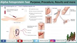Styret i fellesordningen for afp har besluttet å øke premiesatsen for afp i privat sektor fra 2,5 % til 2,6 %. Alpha Fetoprotein Afp Test Purpose Procedure Result And More Lab Tests Guide
