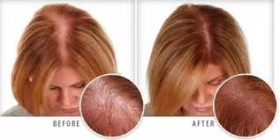 Many experts agree that castor oil is better than coconut oil for addressing hair loss, while coconut oil is ideal for regular hair maintenance. Vitamin E Arganrain Hair And Skin Care Products