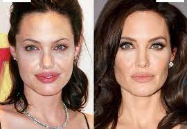 La actriz reveló qué come y cómo entrena para estar en forma. Bichectomia La Cirugia De Moda Entre Los Famosos