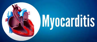 Image result for Myocarditis