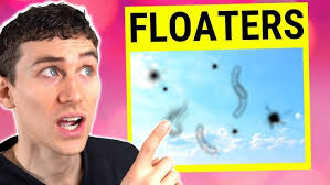 Treating Crossed Eyes