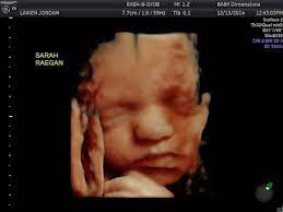 Maybe you would like to learn more about one of these? 3d 4d Ultrasound 36 Weeks Pregnant Baby Dimensions Youtube