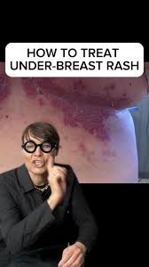 Image result for heat rash under breasts