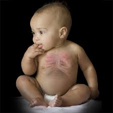 Maybe you would like to learn more about one of these? Dr Sahar Abdullah Screening For Cystic Fibrosis And Down S Syndrome