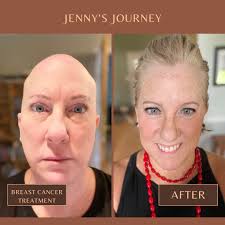 Thank you all for your support and kind words! I wanted to take a moment  and explain a little bit more about my cancer. The type of breast cancer  that I have