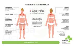 Patología psicosomática puntos dolorosos para el diagnóstico de fibromialgia (31). Fibromialgia Tratamiento Con Cannabis Medicinal Kalapa Clinic