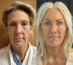 Double Crown in PNW Excellence: Dr. Mark Tseng Wins Gold for Top  Liposuction and Cosmetic Surgery