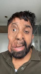 Ever felt like you are screaming inside, but telling the world you are  okay? #mentalhealth #wellbeing #mindset #nf1 #betterhelp @betterhelp