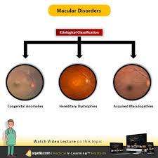 Pin On Sqadia Com Ophthalmology