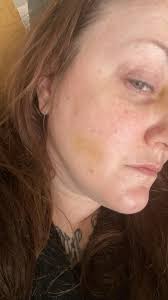 No contact after 3 days, keeping busy