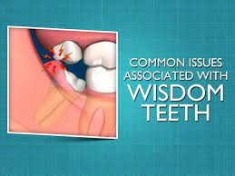 Do You Know Problems With Your Wisdom Teeth Can Cause Cavities Damage To Neighboring Teeth And Gum Disease Dental Decay Wisdom Tooth Infection Dental Health