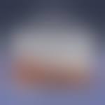 Image result for Pyoderma Gangrenosum