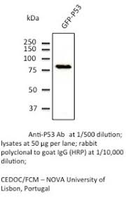 Anti P53 Antibody Goat P53 Polyclonal Antibody Bac16799 1
