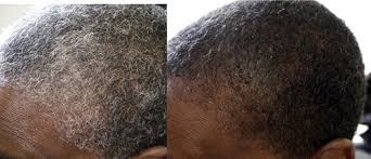 Hairprint® transforms the health of the hair, making it stronger, giving it more body and luster. Scientific Discovery Reverses Gray Hair To Its Natural Color Restores African American Hair To Its True Color With No Harmful Chemicals