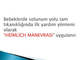 Heimlich manevrası'nın nucidi henry heimlich'in 1974 yılında keşfettiği yöntem, şimdiye kadar binlerce insanın hayatını kurtarmıştır. Bebeklerde Solunum Yolu Tam Tikanikliklarinda Ilkyardim Ppt Indir