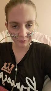 IV Access Medical Procedure Explained