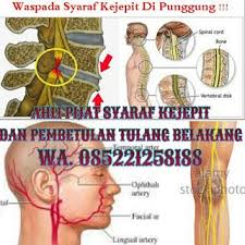 Pijat Syaraf Kejepit Cimahi Bandung Padalarang Cara Mengobati Syaraf Kejepit Bandung Waspadai Sy Carpal Tunnel Terapi Tulang