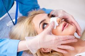 We Provide Best Plastic Surgery In Sydney Rhinoplasty Rhinoplasty Cost Best Plastic Surgeons