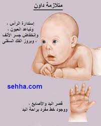 ذوي الاحتياجات الخاصة والعناية بصحة الفم والأسنان كلية طب الاسنان