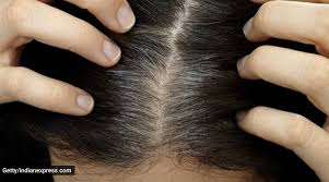 “Expert Reveals Top Techniques to Combat Premature Greying of Hair”