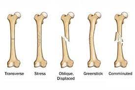Pin On Health