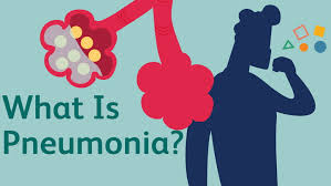 Maybe you would like to learn more about one of these? Is It Bronchitis Or Pneumonia
