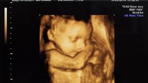 1 bayi dalam kandungan usia kehamilan 14 minggu. Alasan Di Balik Janin Lebih Sering Gerak Di Trimester Tiga