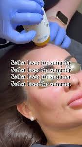 Safest laser for Summer? It’s...