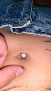 Is This The Start Of A Keloid On A Navel Piercing And How Do I Make It Go Away Noticed It Today Pierced On Feb 4th 2021 With No Prior Healing Issues