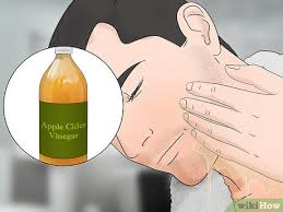 How do i get rid of the prickly feeling once my pubes has been shaved? 3 Ways To Stop Itching After Shaving Wikihow