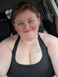 Best cream for reducing rosacea redness