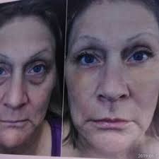 SKINNY BEACH MED SPA