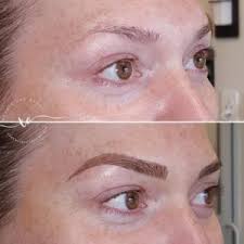 One similarity these two procedures have in common is that both will take four to six weeks to fully heal. Iconic Image Best Atlanta Microblading Microshading Brow Lamination Hair Eyebrow Tattoo Scalp Micropigmentation Combo Ombre Hybrid Brows