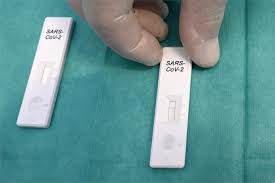 Teste rápido feito em farmácias tem resultado positivo em 15% dos casos. Testes Rapidos Falharam Na Italia No Combate A Segunda Onda De Covid 19 Istoe Dinheiro