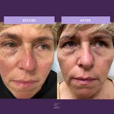 Jacqueline Beer, M.D.