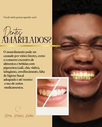 🦷 Dentes Amarelados: E Agora? O amarelamento pode ser causado por vários  fatores, como o consumo excessivo de alimentos e bebidas com pigmentos  (café, chá, vinho), tabagismo, envelhecimento, falta de higiene bucal