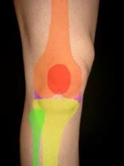 Schmerzen Im Knie Was Habe Ich