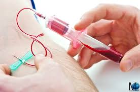 Volume Corpuscolare Medio Mcv Alto Basso Valori Normali E Significato Medicina Online
