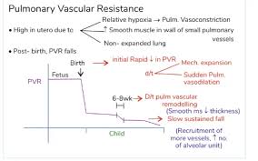 Image result for Delayed Transition from Fetal Circulation