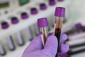 Certain substances present in the blood called the blood markers may be elevated in patients with liver cancer. Blood Test Helped Detect Cancer Before Symptoms Study Finds