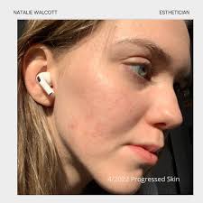 Natalie Walcott Esthetics