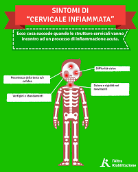 La Tua Cervicale E Infiammata 5 Sintomi Che Te Lo Dicono E Cosa Farci L Altra Riabilitazione
