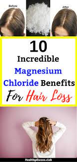 Calcium and magnesium in drinking water, 2009, p. 10 Incredible Magnesium Chloride Benefits For Hair Loss Hair Haircare Health Healthy Beauty B Hair Loss Magnesium Chloride Benefits Hair Loss Remedies